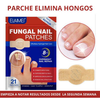 Fungal Nail: 21 Parches innovadores para uñas con hongos