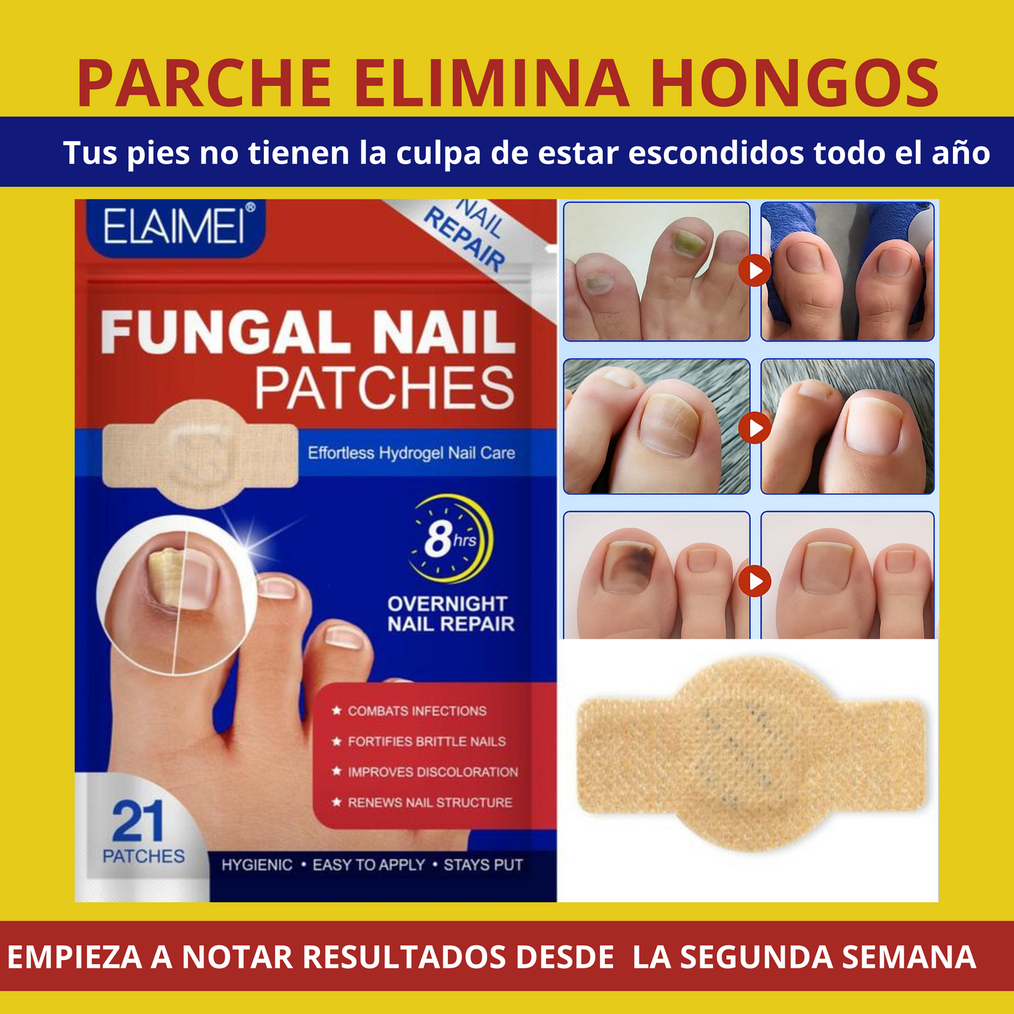 Fungal Nail: 21 Parches para uñas con hongos